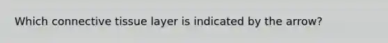 Which connective tissue layer is indicated by the arrow?