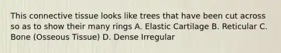 This connective tissue looks like trees that have been cut across so as to show their many rings A. Elastic Cartilage B. Reticular C. Bone (Osseous Tissue) D. Dense Irregular