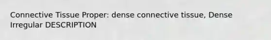 Connective Tissue Proper: dense connective tissue, Dense Irregular DESCRIPTION