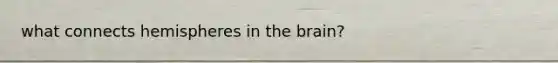what connects hemispheres in <a href='https://www.questionai.com/knowledge/kLMtJeqKp6-the-brain' class='anchor-knowledge'>the brain</a>?