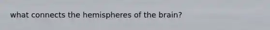 what connects the hemispheres of the brain?