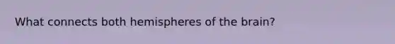What connects both hemispheres of the brain?