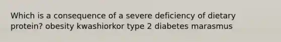 Which is a consequence of a severe deficiency of dietary protein? obesity kwashiorkor type 2 diabetes marasmus