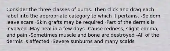 Consider the three classes of burns. Then click and drag each label into the appropriate category to which it pertains. -Seldom leave scars -Skin grafts may be required -Part of the dermis is involved -May heal in a few days -Cause redness, slight edema, and pain -Sometimes muscle and bone are destroyed -All of the dermis is affected -Severe sunburns and many scalds