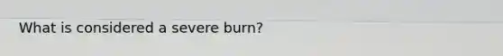 What is considered a severe burn?