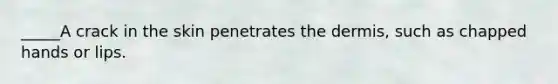 _____A crack in the skin penetrates the dermis, such as chapped hands or lips.
