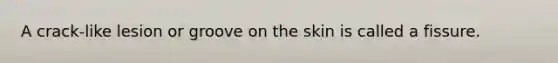 A crack-like lesion or groove on the skin is called a fissure.