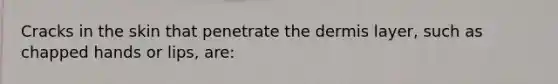 Cracks in the skin that penetrate the dermis layer, such as chapped hands or lips, are:
