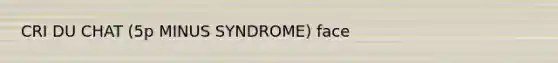 CRI DU CHAT (5p MINUS SYNDROME) face