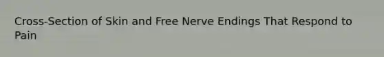 Cross-Section of Skin and Free Nerve Endings That Respond to Pain