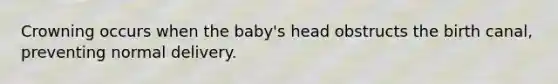 Crowning occurs when the baby's head obstructs the birth canal, preventing normal delivery.