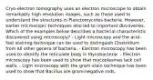 Cryo-electron tomography uses an electron microscope to obtain remarkably high resolution images, such as those used to understand the structures in Planctomycetes bacteria. However, earlier microscopic techniques also led to important discoveries. Which of the examples below describes a bacterial characteristic discovered using microscopy? - Light microscopy and the acid-fast staining technique can be used to distinguish Clostridium from all other genera of bacteria. - Electron microscopy has been used to identify the reticulate body in Mycobacteria. - Electron microscopy has been used to show that mycoplasmas lack cell walls. - Light microscopy with the gram-stain technique has been used to show that Bacillus are gram-negative rods.