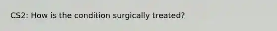 CS2: How is the condition surgically treated?