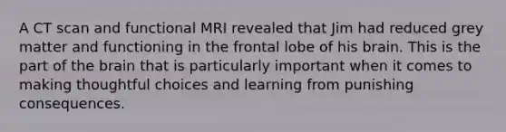 A CT scan and functional MRI revealed that Jim had reduced grey matter and functioning in the frontal lobe of his brain. This is the part of the brain that is particularly important when it comes to making thoughtful choices and learning from punishing consequences.