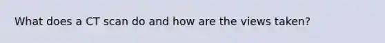 What does a CT scan do and how are the views taken?