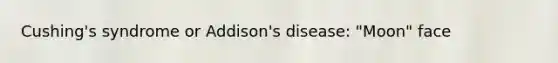 Cushing's syndrome or Addison's disease: "Moon" face