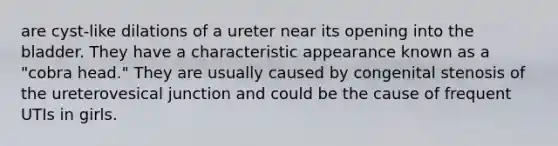 are cyst-like dilations of a ureter near its opening into the bladder. They have a characteristic appearance known as a "cobra head." They are usually caused by congenital stenosis of the ureterovesical junction and could be the cause of frequent UTIs in girls.