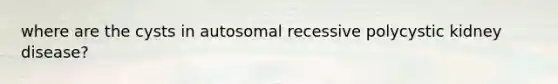 where are the cysts in autosomal recessive polycystic kidney disease?