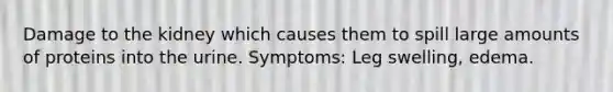 Damage to the kidney which causes them to spill large amounts of proteins into the urine. Symptoms: Leg swelling, edema.