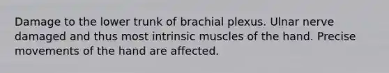 Damage to the lower trunk of brachial plexus. Ulnar nerve damaged and thus most intrinsic muscles of the hand. Precise movements of the hand are affected.