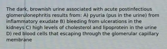 The dark, brownish urine associated with acute postinfectious glomerulonephritis results from: A) pyuria (pus in the urine) from inflammatory exudate B) bleeding from ulcerations in the kidneys C) high levels of cholesterol and lipoprotein in the urine D) red blood cells that escaping through the glomerular capillary membrane