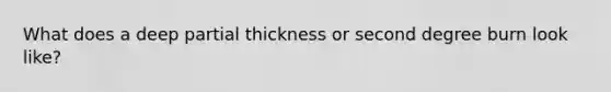 What does a deep partial thickness or second degree burn look like?