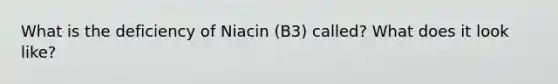 What is the deficiency of Niacin (B3) called? What does it look like?