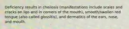 Deficiency results in cheilosis (manifestations include scales and cracks on lips and in corners of the mouth), smooth/swollen red tongue (also called glossitis), and dermatitis of the ears, nose, and mouth.