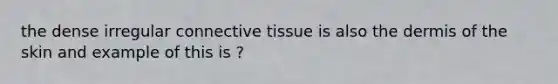 the dense irregular connective tissue is also the dermis of the skin and example of this is ?