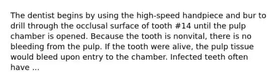 The dentist begins by using the high-speed handpiece and bur to drill through the occlusal surface of tooth #14 until the pulp chamber is opened. Because the tooth is nonvital, there is no bleeding from the pulp. If the tooth were alive, the pulp tissue would bleed upon entry to the chamber. Infected teeth often have ...