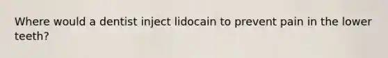 Where would a dentist inject lidocain to prevent pain in the lower teeth?