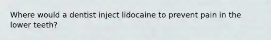 Where would a dentist inject lidocaine to prevent pain in the lower teeth?