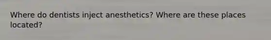 Where do dentists inject anesthetics? Where are these places located?