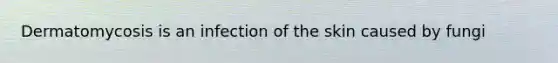 Dermatomycosis is an infection of the skin caused by fungi