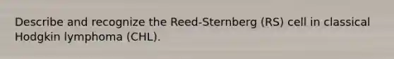 Describe and recognize the Reed-Sternberg (RS) cell in classical Hodgkin lymphoma (CHL).