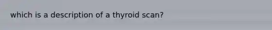 which is a description of a thyroid scan?