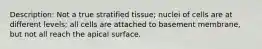 Description: Not a true stratified tissue; nuclei of cells are at different levels; all cells are attached to basement membrane, but not all reach the apical surface.