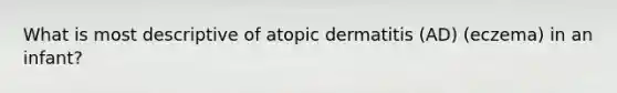 What is most descriptive of atopic dermatitis (AD) (eczema) in an infant?