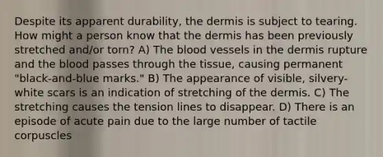 Despite its apparent durability, <a href='https://www.questionai.com/knowledge/kEsXbG6AwS-the-dermis' class='anchor-knowledge'>the dermis</a> is subject to tearing. How might a person know that the dermis has been previously stretched and/or torn? A) <a href='https://www.questionai.com/knowledge/k7oXMfj7lk-the-blood' class='anchor-knowledge'>the blood</a> vessels in the dermis rupture and the blood passes through the tissue, causing permanent "black-and-blue marks." B) The appearance of visible, silvery-white scars is an indication of stretching of the dermis. C) The stretching causes the tension lines to disappear. D) There is an episode of acute pain due to the large number of tactile corpuscles