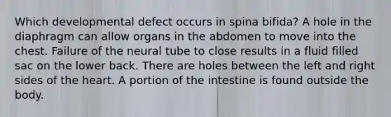 Which developmental defect occurs in spina bifida? A hole in the diaphragm can allow organs in the abdomen to move into the chest. Failure of the neural tube to close results in a fluid filled sac on the lower back. There are holes between the left and right sides of the heart. A portion of the intestine is found outside the body.