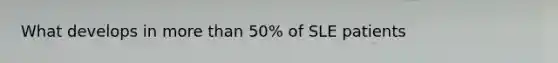 What develops in more than 50% of SLE patients