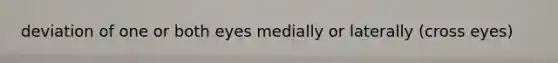 deviation of one or both eyes medially or laterally (cross eyes)