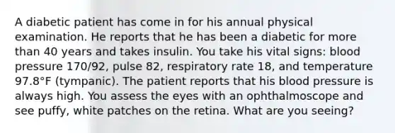 A diabetic patient has come in for his annual physical examination. He reports that he has been a diabetic for more than 40 years and takes insulin. You take his vital signs: blood pressure 170/92, pulse 82, respiratory rate 18, and temperature 97.8°F (tympanic). The patient reports that his blood pressure is always high. You assess the eyes with an ophthalmoscope and see puffy, white patches on the retina. What are you seeing?