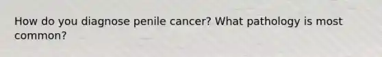 How do you diagnose penile cancer? What pathology is most common?