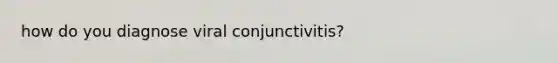 how do you diagnose viral conjunctivitis?