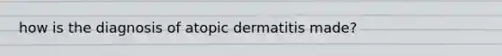 how is the diagnosis of atopic dermatitis made?