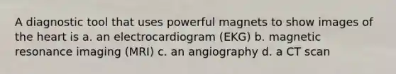 A diagnostic tool that uses powerful magnets to show images of <a href='https://www.questionai.com/knowledge/kya8ocqc6o-the-heart' class='anchor-knowledge'>the heart</a> is a. an electrocardiogram (EKG) b. magnetic resonance imaging (MRI) c. an angiography d. a CT scan