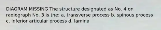 DIAGRAM MISSING The structure designated as No. 4 on radiograph No. 3 is the: a. transverse process b. spinous process c. inferior articular process d. lamina