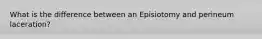 What is the difference between an Episiotomy and perineum laceration?