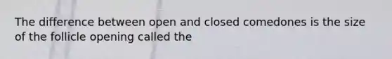 The difference between open and closed comedones is the size of the follicle opening called the